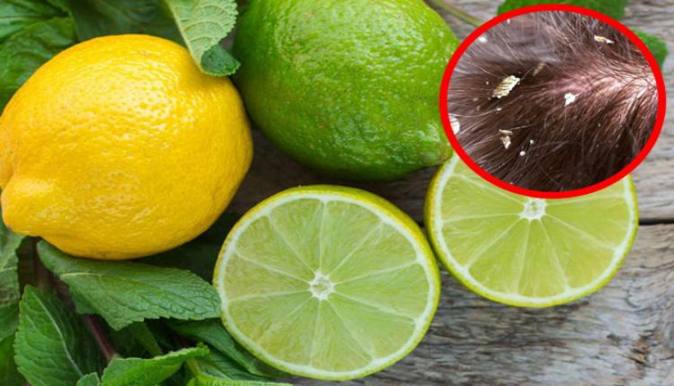 Áp dụng cách gội đầu sạch gàu bằng chanh
