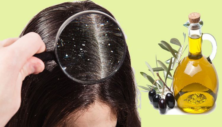 Tham khảo cách trị gàu mảng bằng dầu oliu Tham khảo cách trị gàu mảng bằng dầu oliu