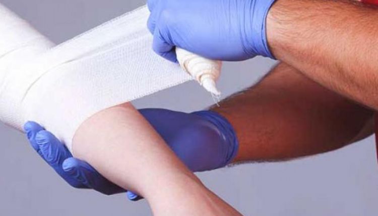 Băng vết bỏng đúng cách hỗ trợ quá trình phục hồi vết bỏng