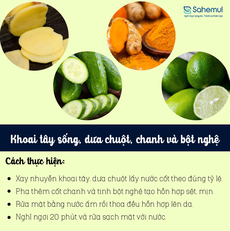 hon-hop-khoai-tay-tri-mun