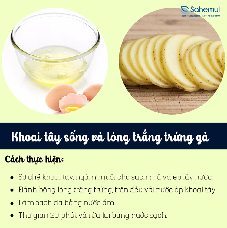 khoai-tay-song-long-trang-trung