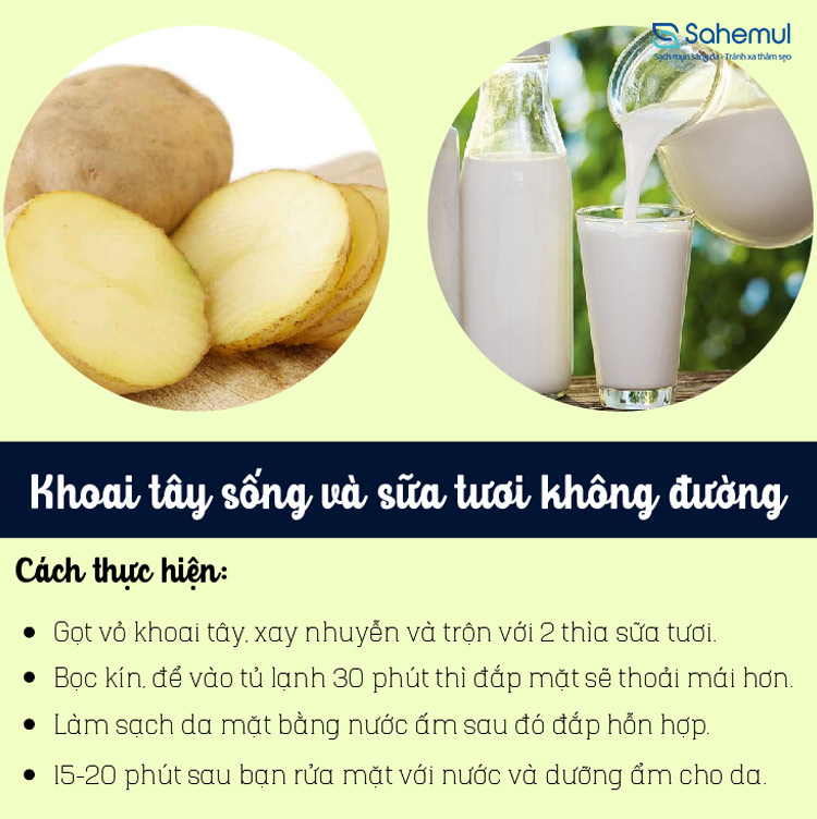 khoai-tay-sua-tuoi-khang-khuan