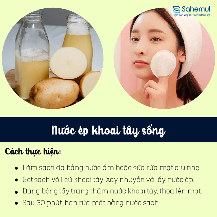 nuoc-ep-khoai-tay-tri-mun