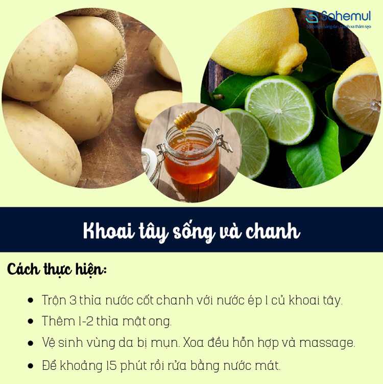 tri-mun-bang-khoai-tay-chanh