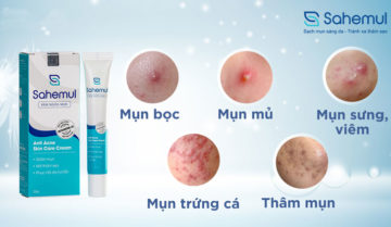 Top 10 kem trị mụn sưng đỏ mang lại hiệu quả nhanh chóng Top 10 kem trị mụn sưng đỏ mang lại hiệu quả nhanh chóng
