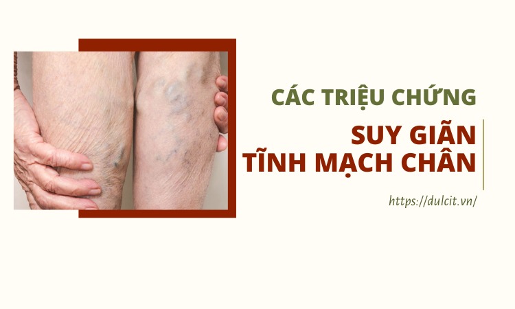 trieu-chung-gian-tinh-mach